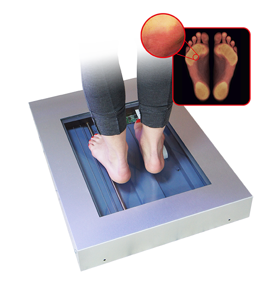 PODOSCANER PRO 3D - skaner podologiczny z oprogramowaniem rozszerzonym do archiwizacji badań diagnostycznych