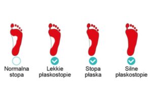 Wkładki ortopedyczne dla dzieci 