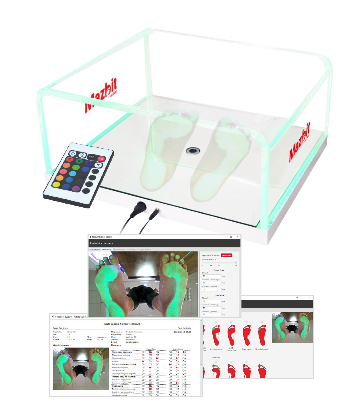 PODOSCOPE FHD1080 - podoskop diagnostyczny z kamerą