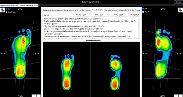 Dane diagnostyczne z maty tensometrycznej MAZBIT