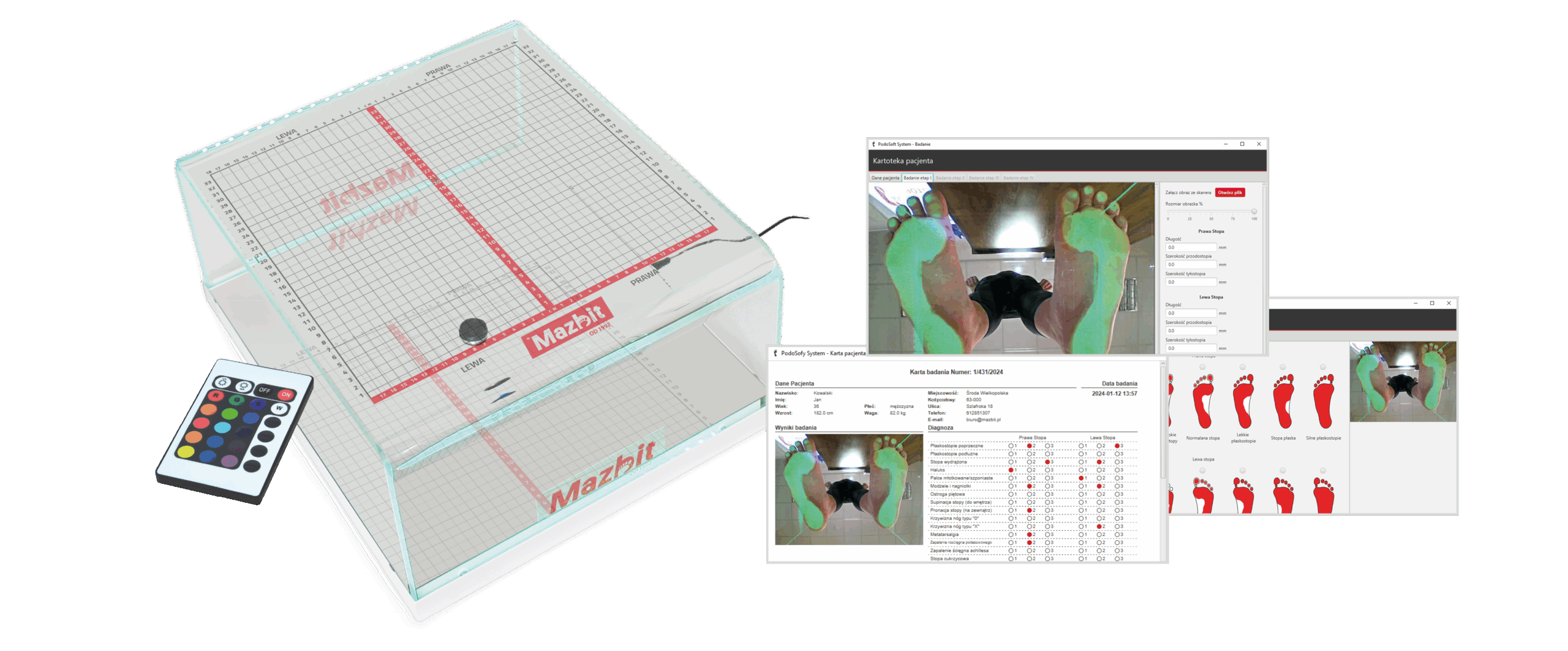 Podoskop diagnostyczny do badania stóp PODOSCOPE 4K MAZBIT